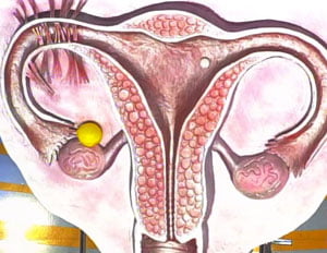 Киста яичника и беременность